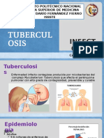 Tuberculosis