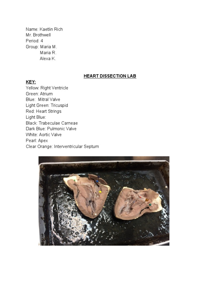 Heart Dissection Lab Key PDF