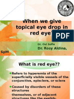 When We Give Topical Ed in Red Eye