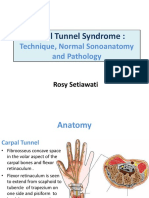 Carpal Tunnel Syndrome