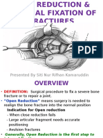 Open Reduction Internal Fixation Rif