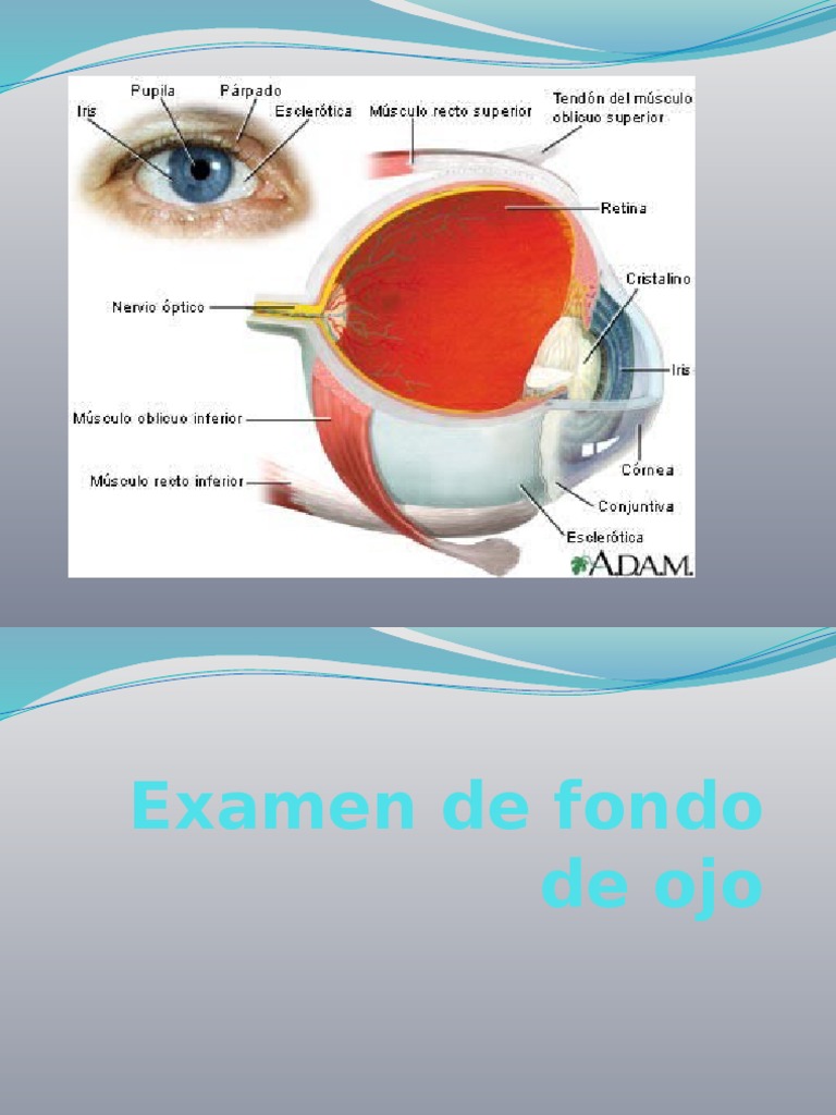 Técnicas y hallazgos en oftalmoscopia | PDF | Enfermedades y trastornos ...