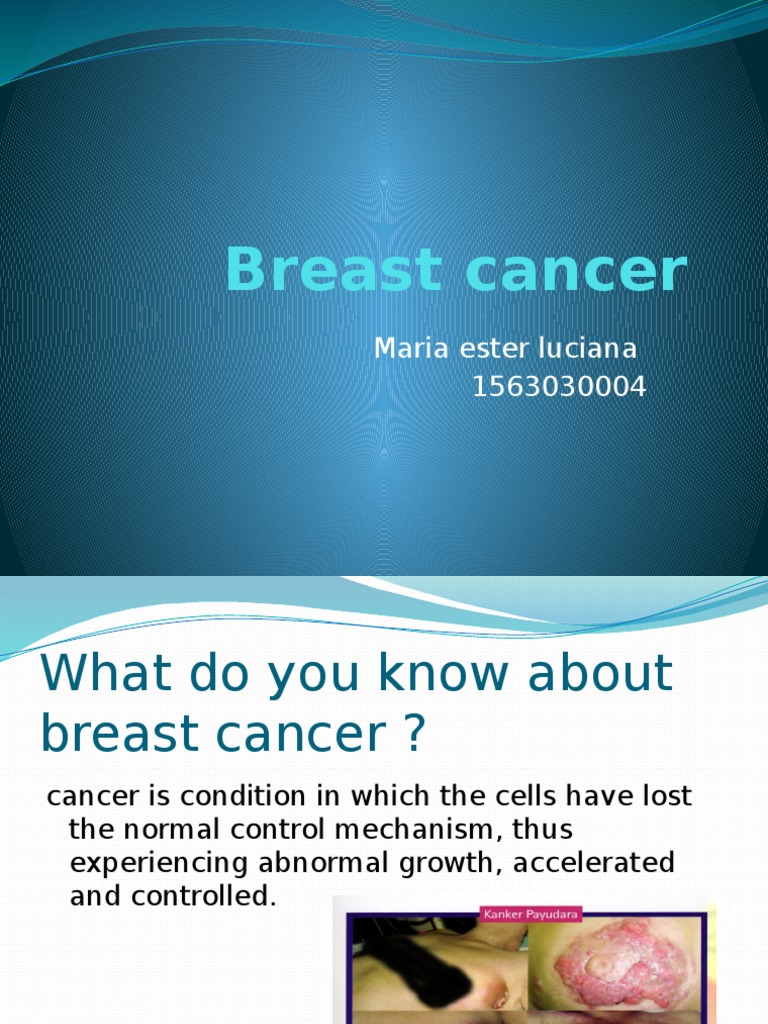 presentation on breast cancer