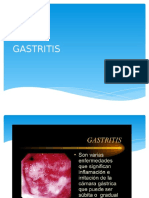 Gastritis.pptx 1