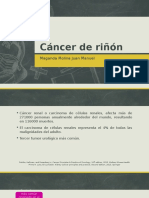 Cáncer de Riñón