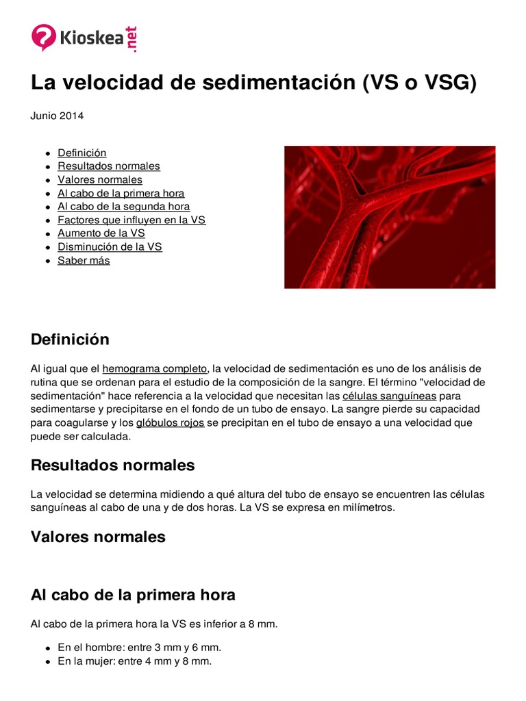 La Velocidad de Sedimentacion Vs o VSG 1637 Mvi5o5 | PDF | Sangre | Anemia