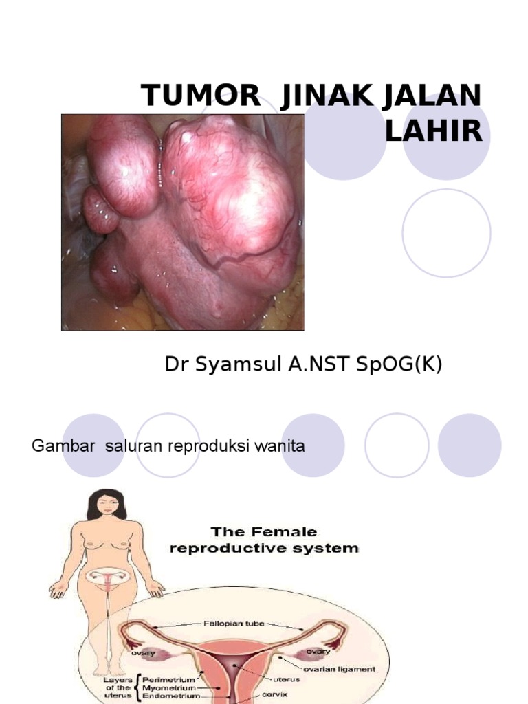 Presentasi Tumor Ginekologi