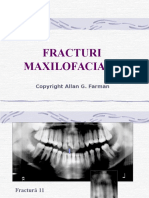 LP Fracturi Maxilofaciale2