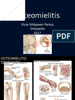 Osteomielitis