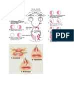 Pituitary Adenomas