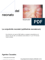 Oftalmia Del Neonato