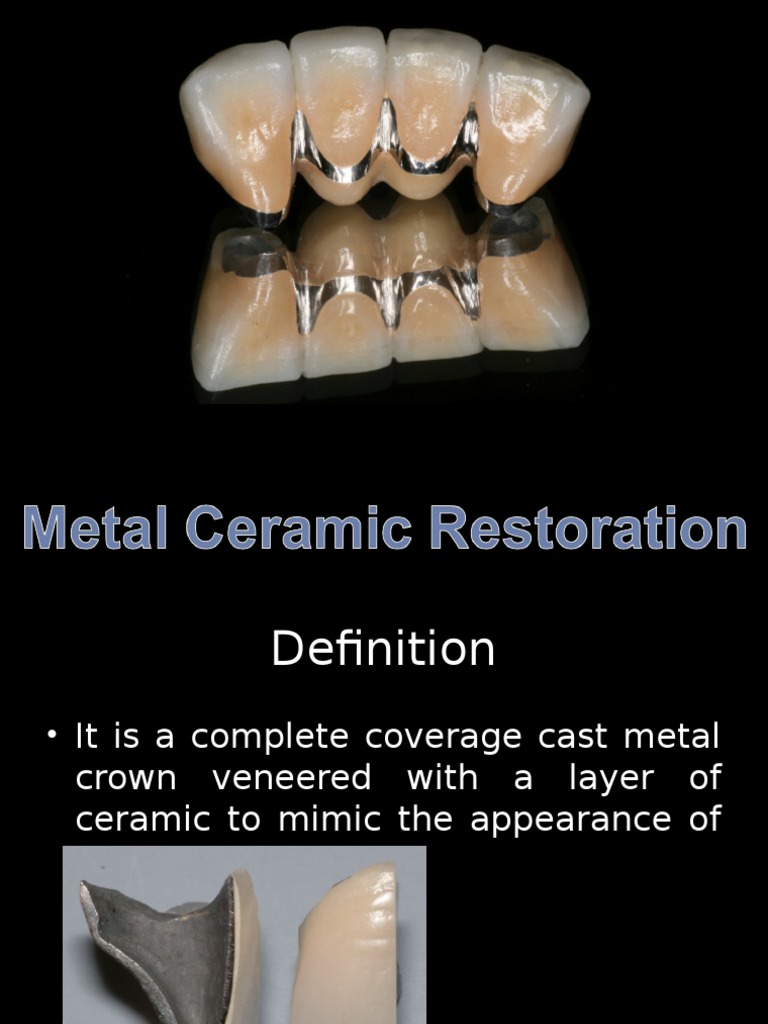 3 Modified METALCERAMIC RESTORATION SB 09132015.ppt Ceramics Metals