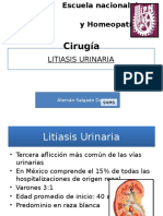 LITIASIS URINARIA