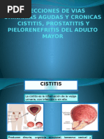 Cipro xr infeccion urinaria