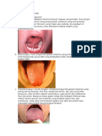 Anomali perkembangan lidah dan penjelasan berbagai jenis kelainannya