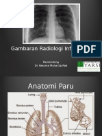 Radiologi Infeksi Paru Sasha