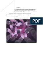 Definitia Pneumoniei Pneumococice - Model Slide
