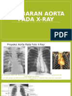 Gambaran Aorta Pada X-Ray