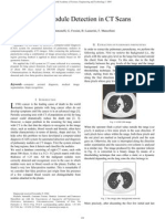 Lung Nodule Detection in CT Scans Using CAD