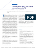 Laparoscopic en Bloc Resection of T4 Colon Cancer - Chen2016