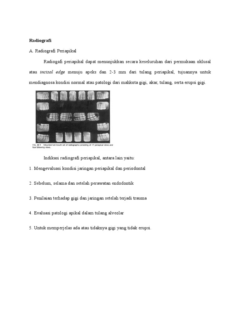 Radiografi PULPITIS IRREVERSIBEL | PDF