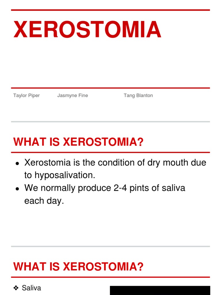 Xerostomia PDF Medical Specialties Clinical Medicine