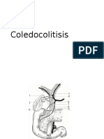 Coledocolitiasis