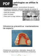 Operculectomía: Técnica y Procedimiento | PDF | Diente humano ...