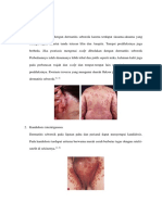 Diagnosis Banding Ds