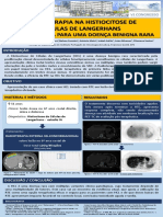 Radioterapia Na Histiocitose de Células de Langerhans: Indicação para Uma Doença Benigna Rara