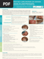 BRAQUITERAPIA NO CARCINOMA DA MAMA