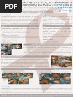 BRAQUITERAPIA INTERSTICIAL NO TRATAMENTO DO CARCINOMA DA MAMA - MÉTODOS E CRITÉRIOS