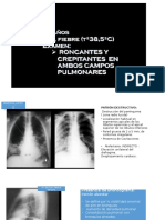 RX de Torax