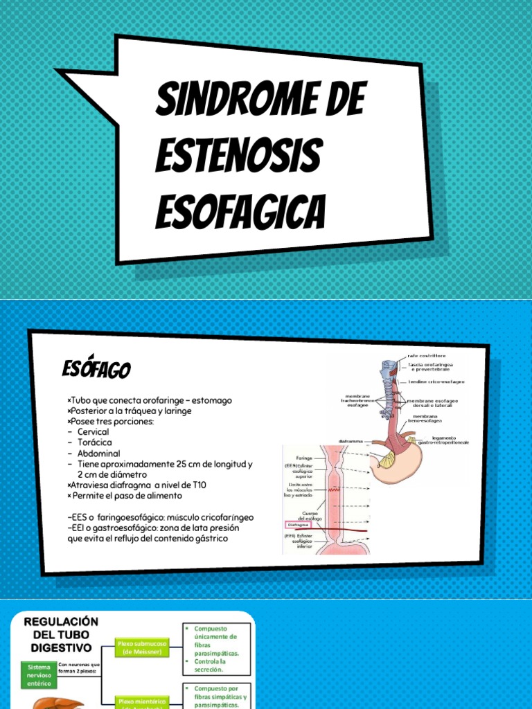 Estenosis Esofagica | PDF | Especialidades Medicas | Enfermedades y ...