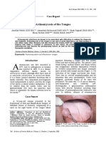 Rare Case of Tongue Actinomycosis