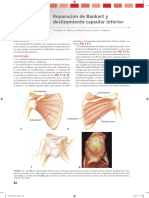 Reparación de Bankart y Deslizamiento Capsular Inferior: Capítulo