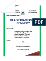 Clasificacion d Kennedy (1)