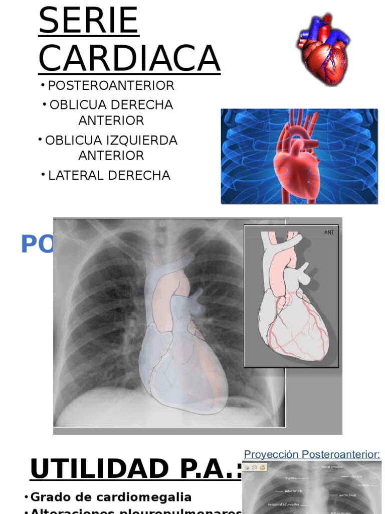 Serie Cardiaca | PDF