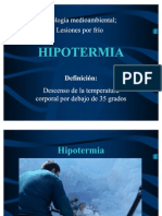 Hipotermia