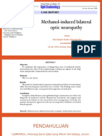 Methanol-Induced Bilateral Optic Neuropathy