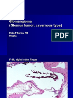 Glomangioma (Glomus Tumor, Cavernous Type), F 48, Right Index Finger.