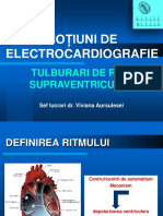 2tulburari Ritm Supraventricular - Bak