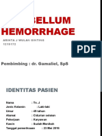 Cerebellum Hemorrhage Cbd Dr.terry