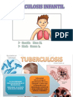 Tubrculosis en Niños