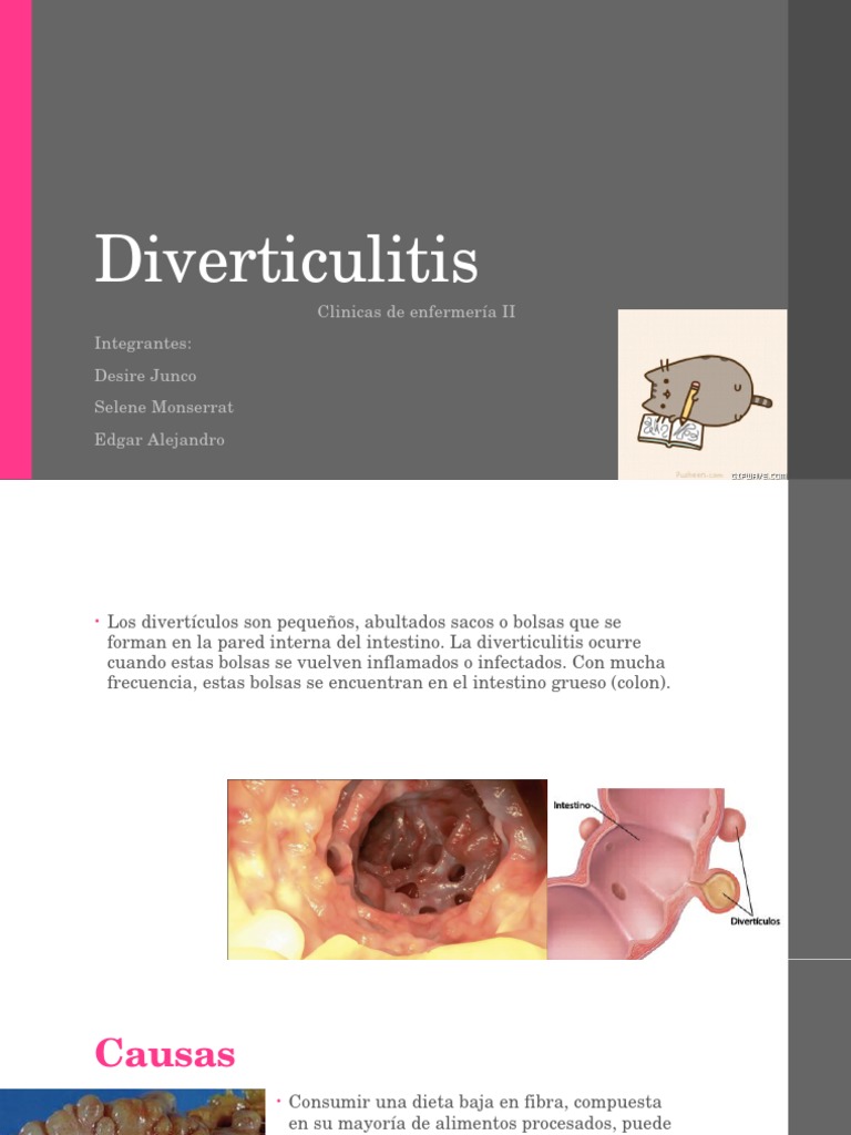 Diverticulitis | Medicina CLINICA | Enfermedades y trastornos