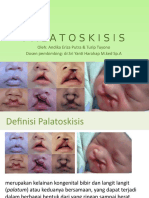 PPT Palatoskisis