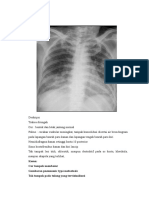 Foto Thorax Dan Deskripsi