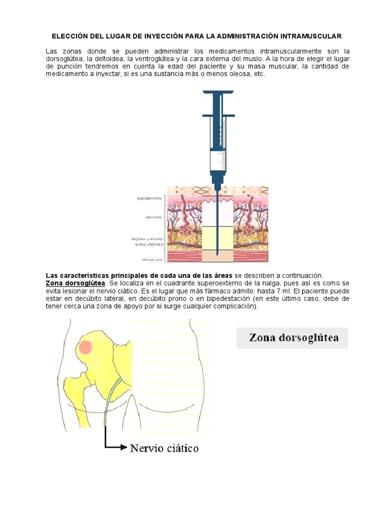 Zonas de Inyección Intramuscular | PDF | Inyección (medicina ...