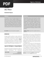Signo del halo. rx.pdf