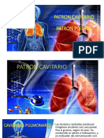 Practico Patron Cavitario y Pulmonar
